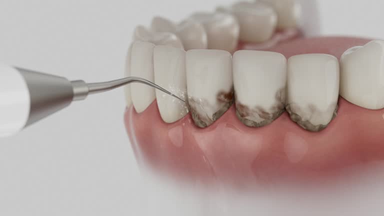 Reliable Emergency Dentist contractor in Montevallo, AL by Smile Center Dentistry